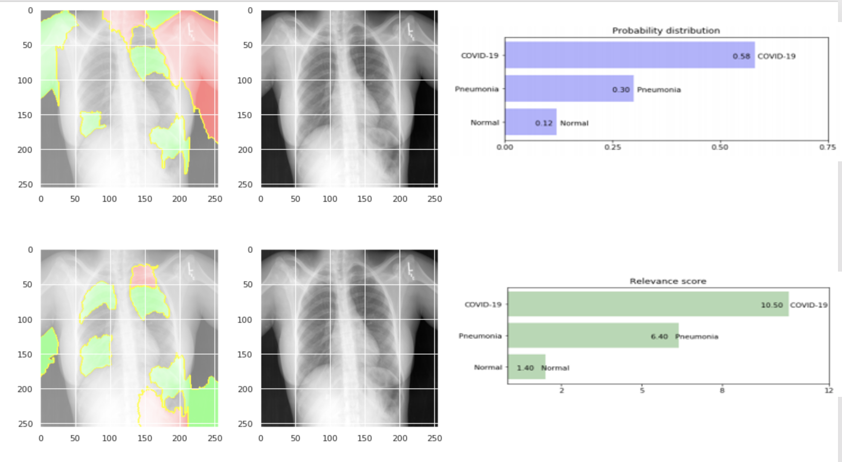 Chest X-ray XAI